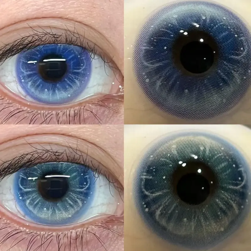 EyeLensy Jellyfish Glow Blue | 6 Months